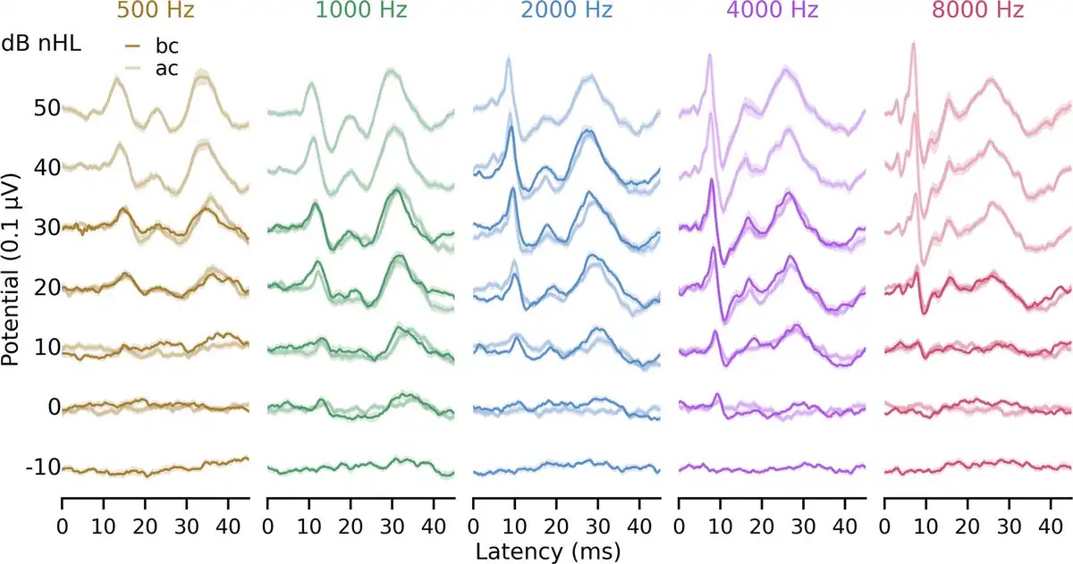 Bone conduction pABR paper published